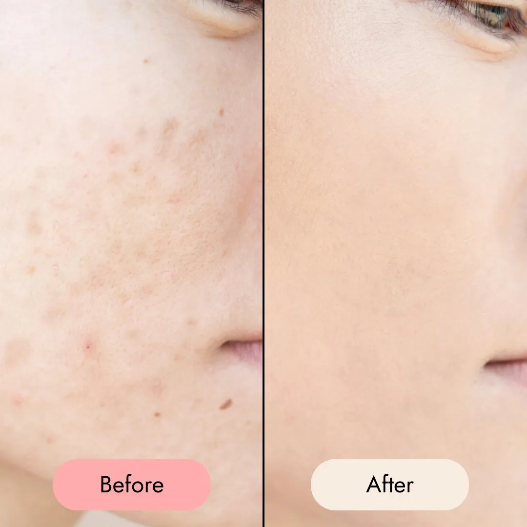Purifying Toner