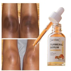 Turmeric Lemon Oil Brightening and Lightening Dark Spots, Acne Brightening Dark Spot Correcting Facial Whitening Serum